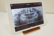 Dental X (iPadを用いた説明用ツール)